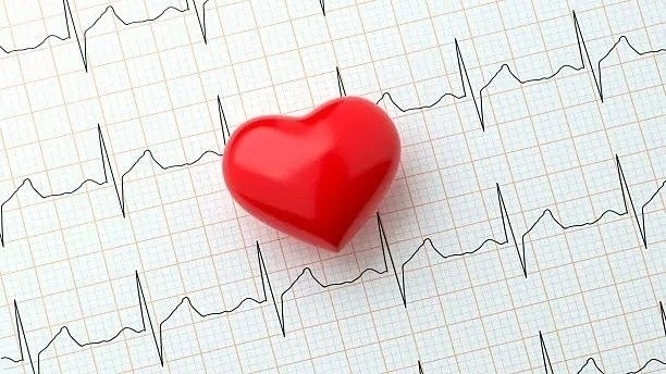 ECG a domicilio