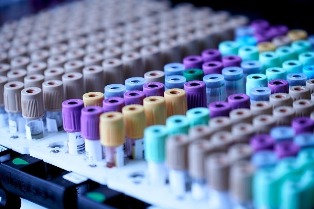 Blood collection, laboratory and breath tests